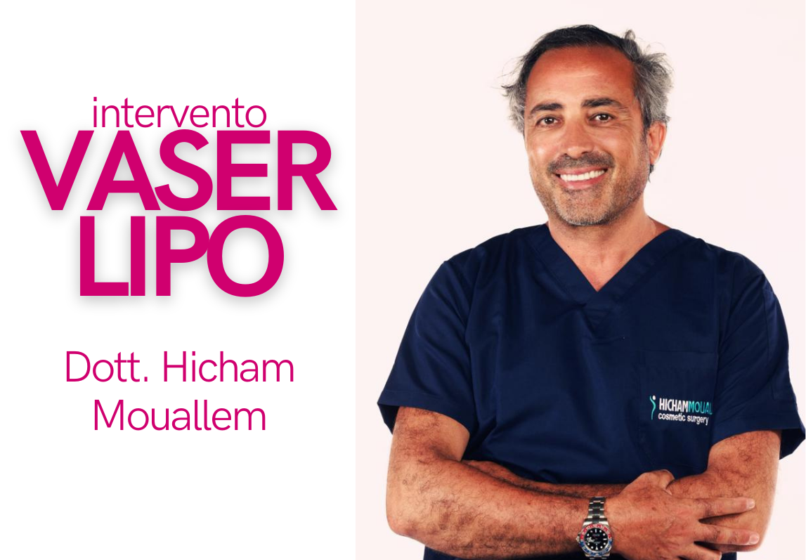 Liposuzione Vaser, che cos’è e cosa cambia dalla liposuzione classica