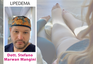 Lipedema: il ruolo del sistema vascolare e della terapia compressiva | Intervista al Dott. Mangini